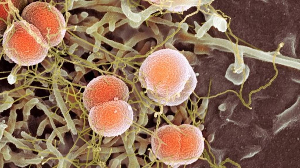 Invasive haemophilus influenzae disease in adults