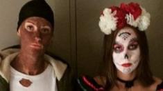 Basketballer Alice Kunek posted this photo of herself wearing blackface to her Instagram account