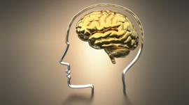 An image of a brain