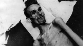 Víctima de 37 años del Invierno del Hambre, en una camilla en 1944.