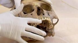 One of the skulls found in Mexico