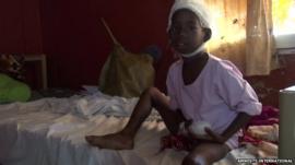 Injured child in hospital, pic from December 2013 courtesy of Amnesty International