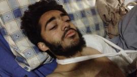 <b>Mohammad Hilal</b> in Peshawar hospital, Pakistan, 17 December 2014 - _79796141_mohammadhilal