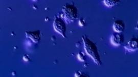 T cells attacking cancer cells