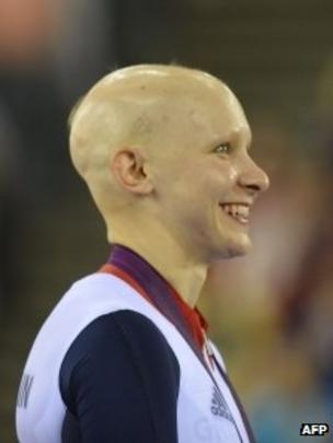 Image caption Joanna Rowsell was diagnosed with alopecia aged 10 - _62045700_62045699