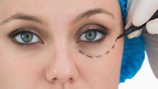 Eyelid surgery