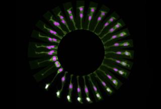 Dividing stem cell in the brain - Paula Alexandre, University College London