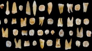 an array of human teeth from the cave site