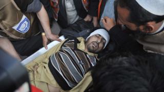 Pakistani paramedics transport a bomb blast victim to a hospital in Peshawar on December 29, 2015.