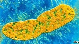 Klebsiella pneumoniae