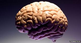 A brain