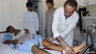 A doctor treats a wounded Afghan civilian in Khost where a suicide bomber killed at least 16 people on 20 June