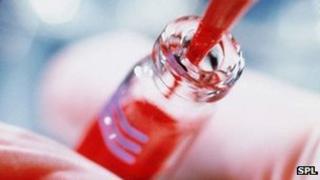 blood sample