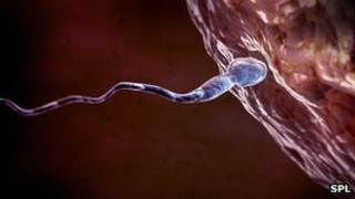 Sperm