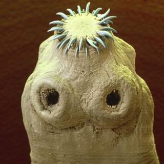 Tapeworm