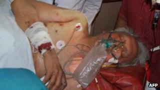 Man injured in the attack on Congress party officials in Chhattisgarh state, India (26 May 2013)