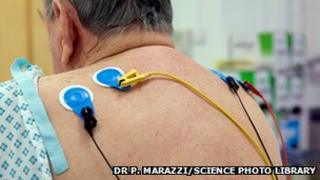 Heart monitoring