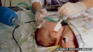 Infant in intensive care