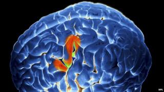 Brain activity during speech