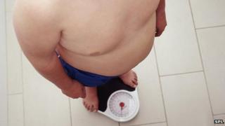 Obese child
