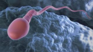 Sperm
