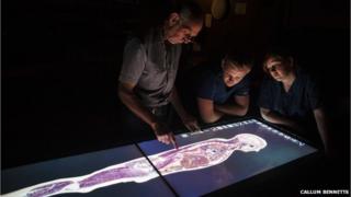virtual cadaver