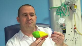 John Cousins with a model of his kidney