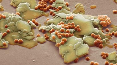 Why are microbeads controversial? 
