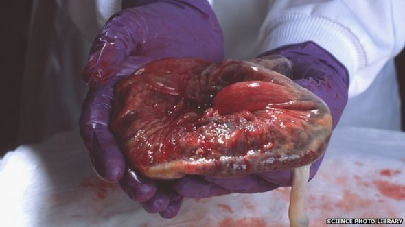 A human placenta