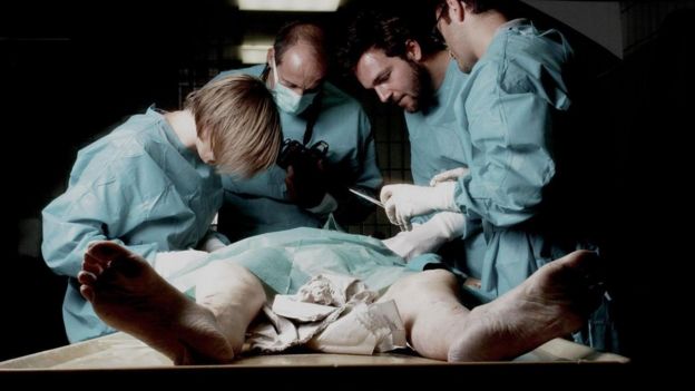 kadavradan organ nakli