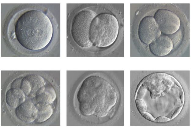 Human embryo development