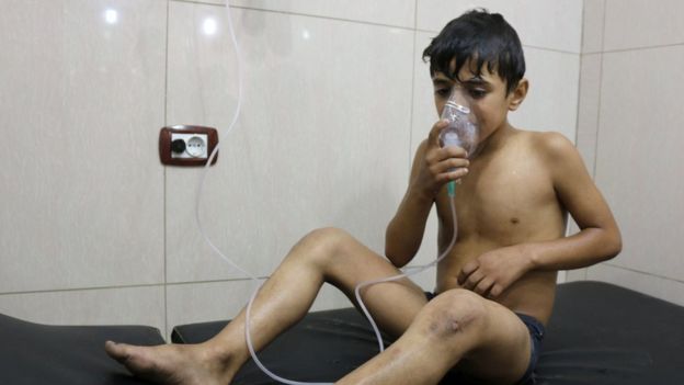 Child uses oxygen mask after alleged chlorine gas attack in Aleppo. 6 Sept 2016