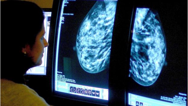 Doctora examina las radiografías de unos senos.