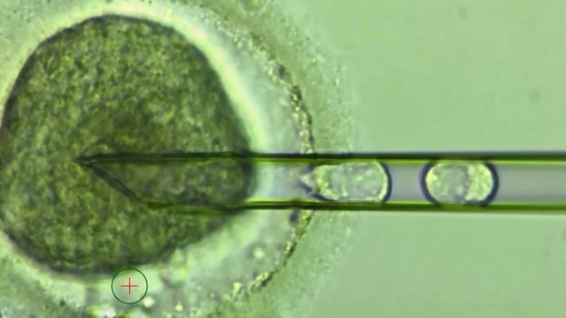an embryo