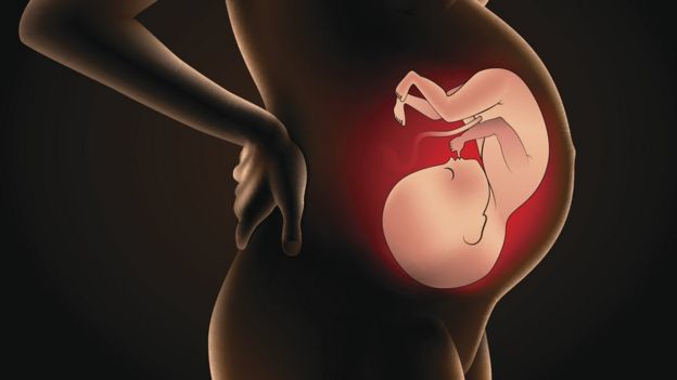 Ilustração mostrando gravidez