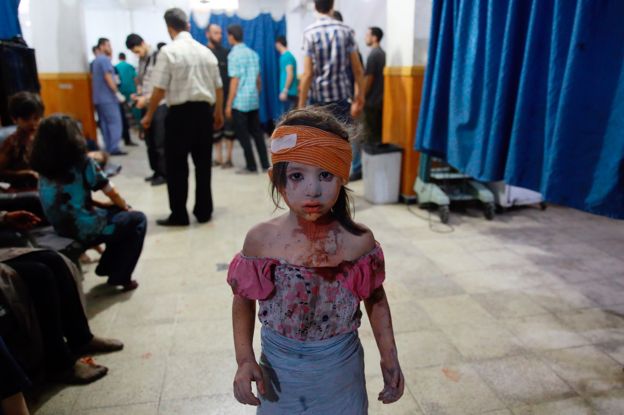Niña herida en un hospital sirio