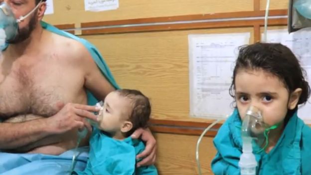 Oksijen maskeleri takılan çocuklar