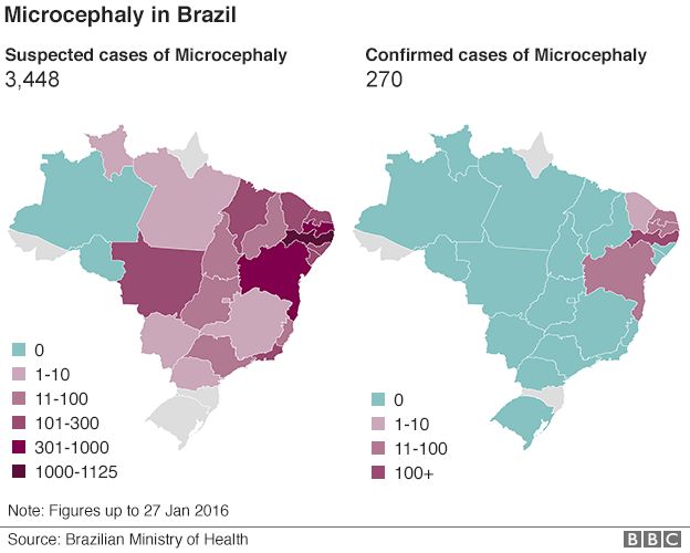 _88059887_brazil_microcephaly_cases_624.png