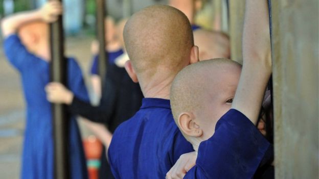 CrianÃ§as albinas na TanzÃ¢nia