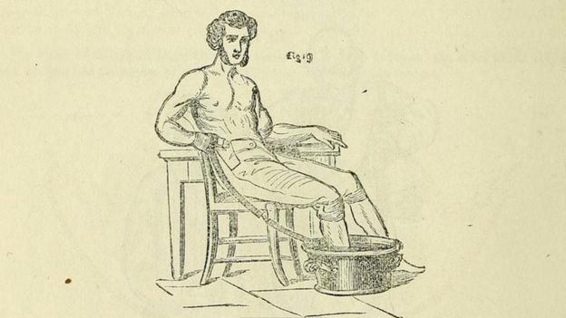 Charles Dickens bacaklarındaki ağrı için elektrik kemerini muhtemelen bu şekilde kullandı.
