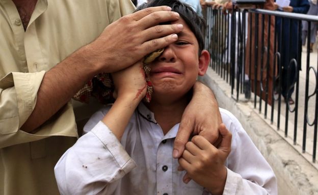 A boy who was injured in an earthquake cries outside a hospital in Peshawar, Pakistan, 10 April 2016