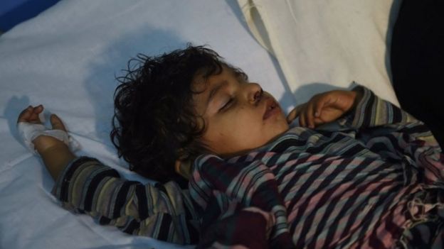 An injured child is treated in hospital in Sehwan (16 Feb 2017)