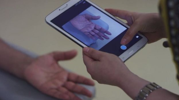 Doctor photographing patient's hand on a tablet