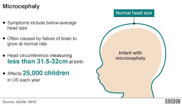 Graphic showing babies' head size