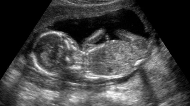 anne karnında fetüs