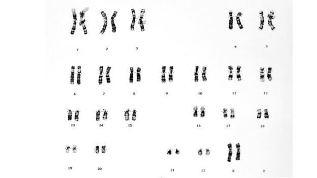 23 pares de cromosomas