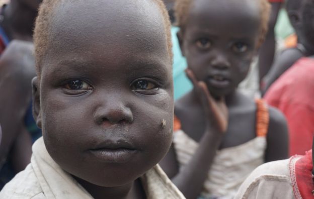 Malnourished children in the Bentiu protection site