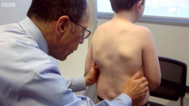 El doctor Kaplan examinando a un niño con FOP