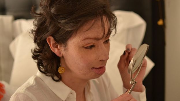 Natalia Ponce de León asegura que le perdió el miedo al espejo tras el ataque.