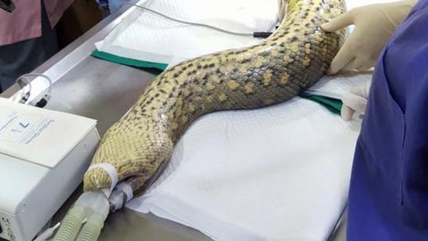 Anaconda on breathing tube